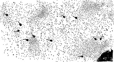 Пожиратели микробов - бактериофаги - похожи на круглые шарики с хвостиком; хвостик имеет длину немного больше 100 000-й доли миллиметра, а тельце - еще меньше. Это настоящие лилипуты